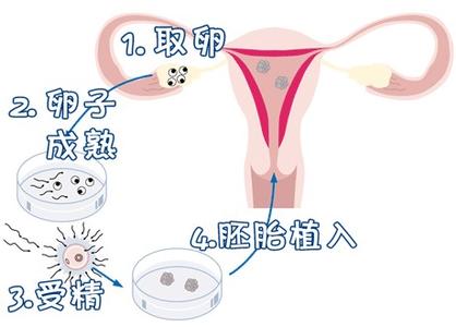 专家肖像